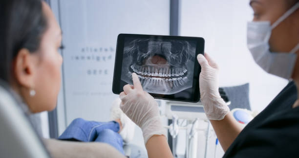 Licensed Teeth Whitening service in Lakeview, CA - Smile Center Dentistry